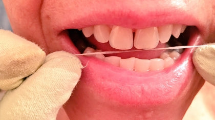 Floss with gloves on?